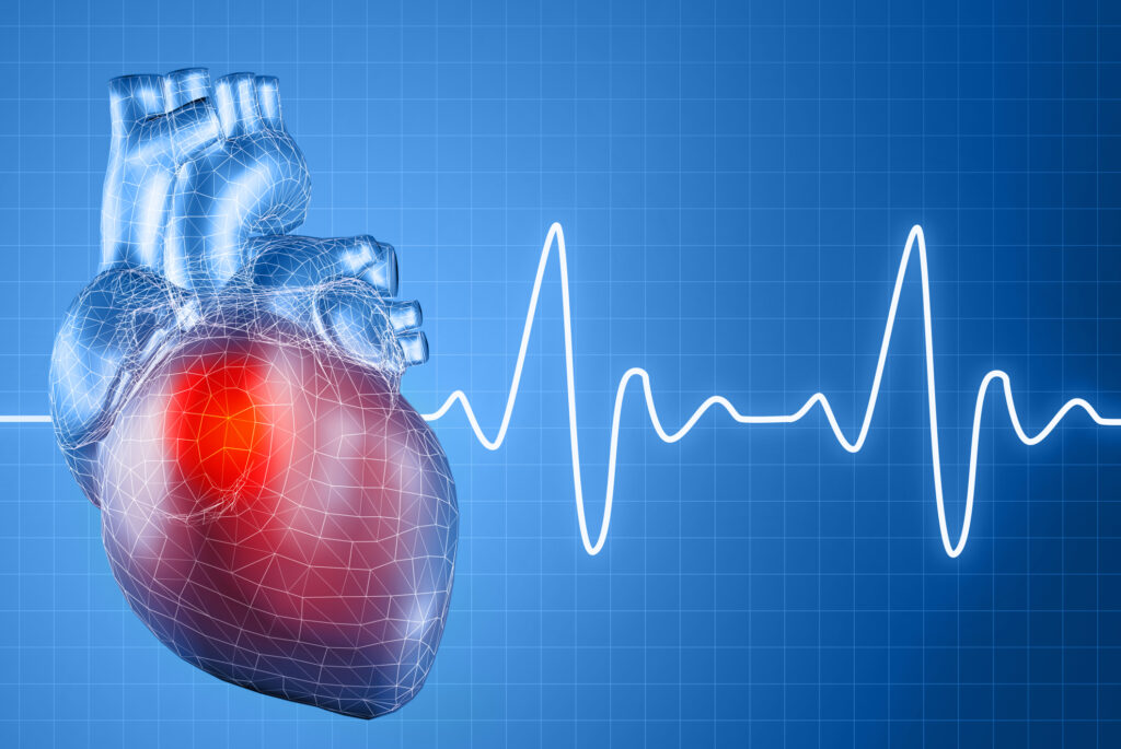 Аритмия, или нерегулярное сердцебиение: ее виды, причины, симптомы, диагностика и лечение